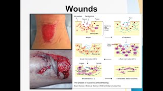 Wounds [upl. by Filmore]