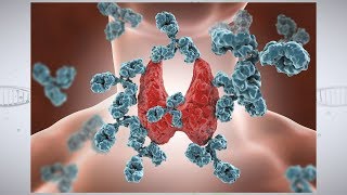 Thyroid Cancer Symptoms amp Early Warning Signs [upl. by Cormier619]