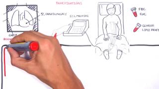 Acute Coronary Syndrome DETAILED Overview MI STEMI NSTEMI [upl. by Amsaj362]