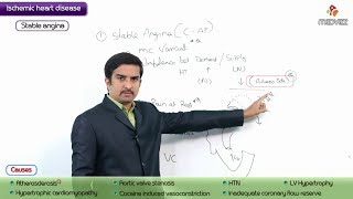 Pathology of Angina Pectoris  Stable Angina  USMLE Step 1 coronary artery disease [upl. by Aidam53]