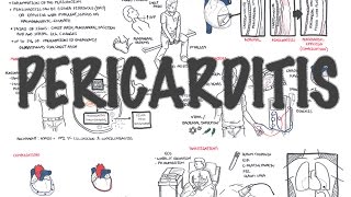 Pericarditis  Overview signs and symptoms pathophysiology diagnosis treatment [upl. by Horton117]