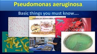 Pseudomonas aureginosaClear overview [upl. by Sabian565]